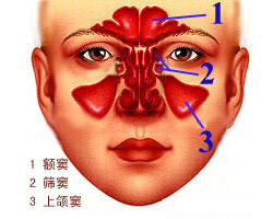 健康 用药常识 医药常识 > 正文 鼻涕倒流,鼻涕常从嗓子里出来,是鼻窦